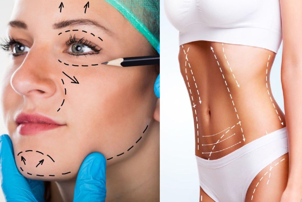 Ten Aesthetic Surgeries