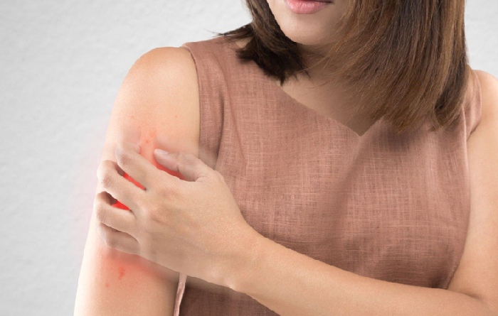 What Causes Dermatitis