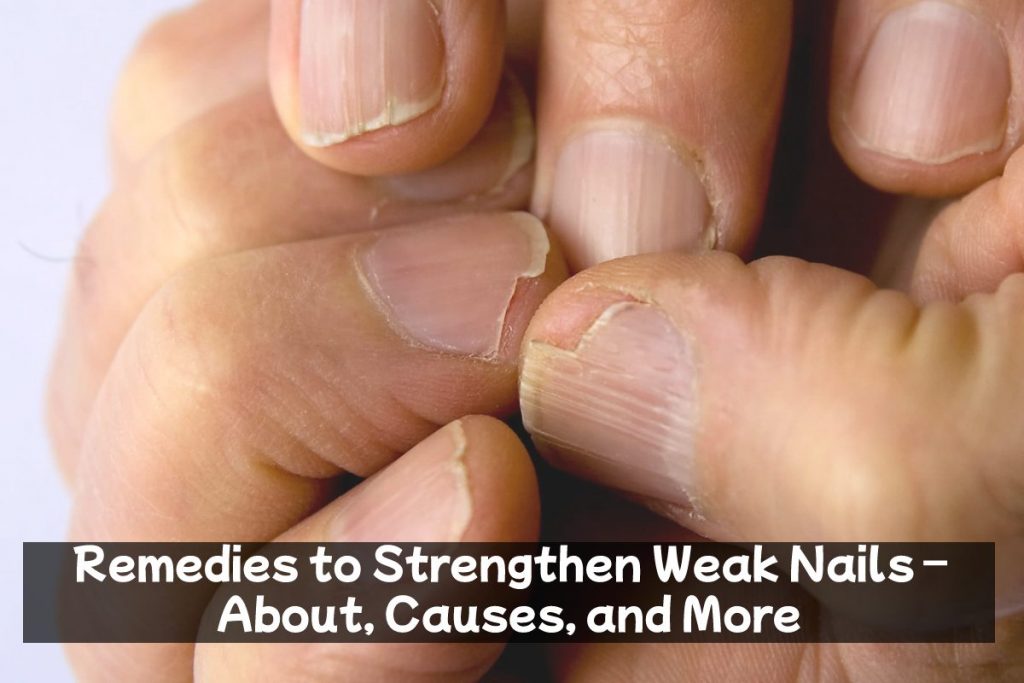 Remedies to Strengthen Weak Nails – About, Causes, and More