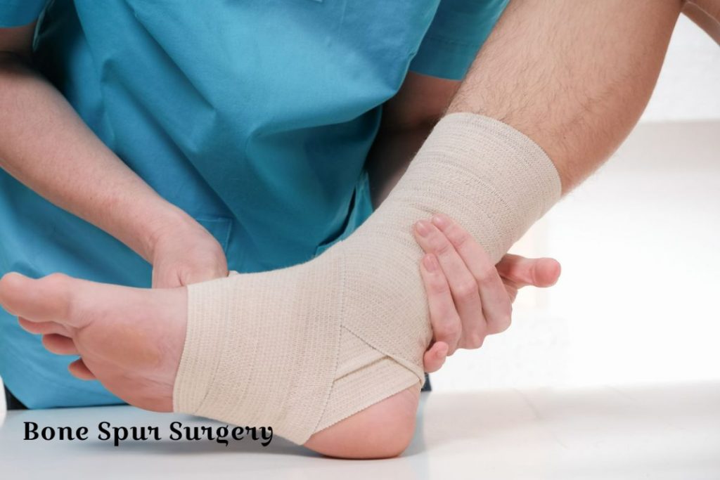 Exciting Facts About Bone Spur Surgery