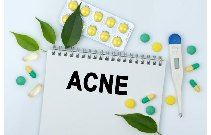 Is Aviane Birth Control Good For Acne