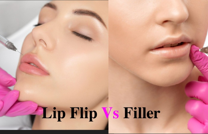 Lip Flip Vs Filler