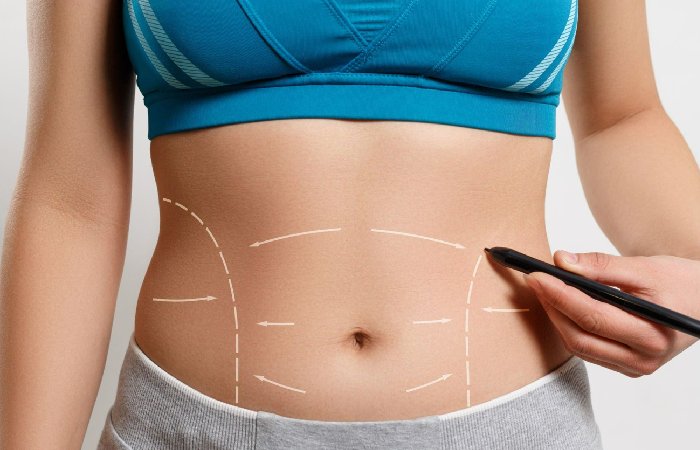 Tummy Tuck -Beyond Beauty Plastic Surgery